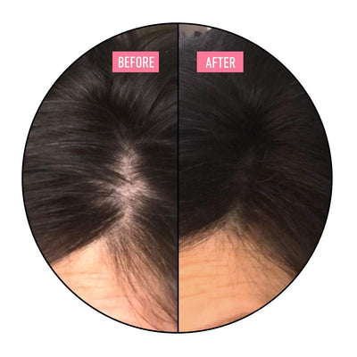Hair Thickening Fibers - Completely Conceals Hair Loss by BOLDIFY INC.